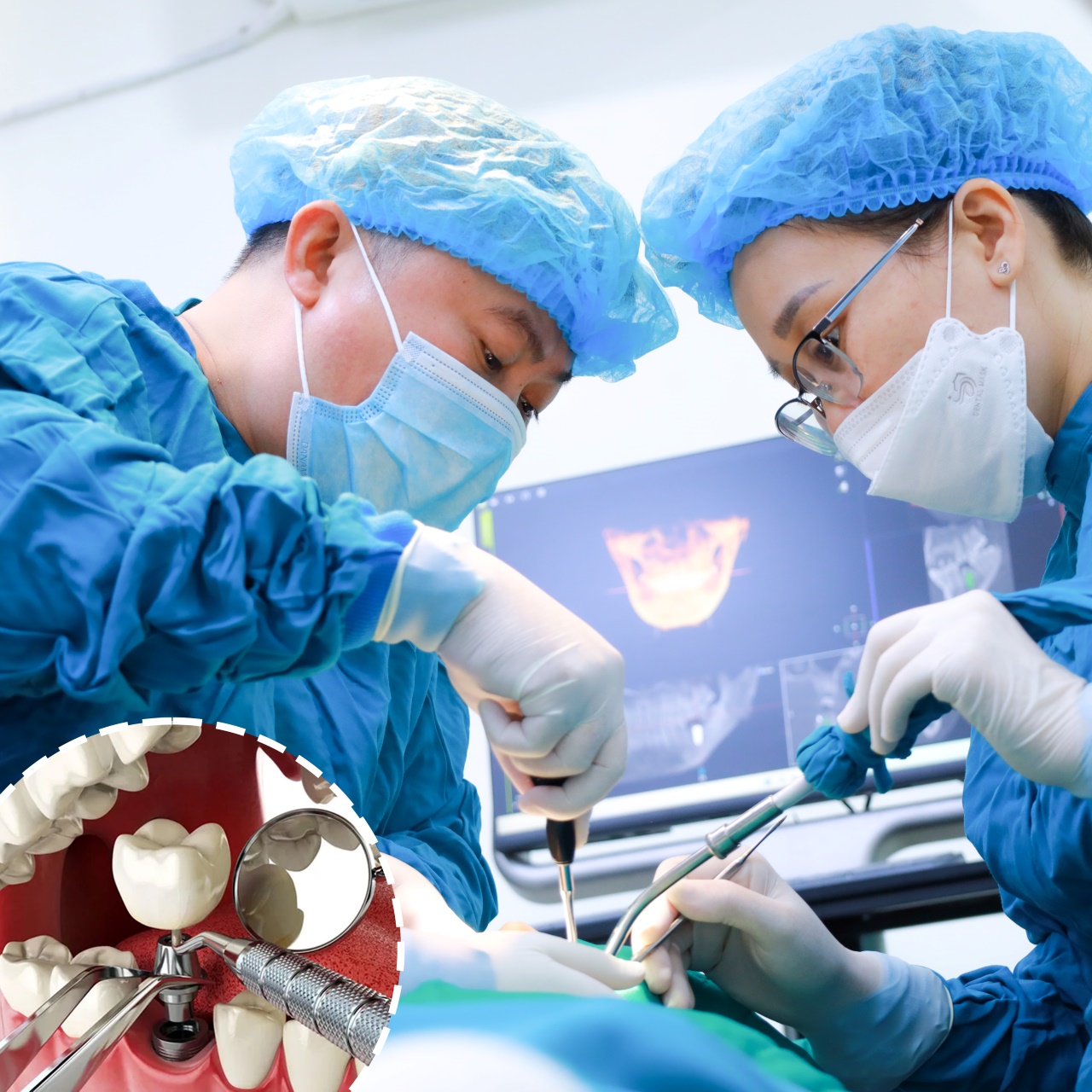 Cấy ghép implant
